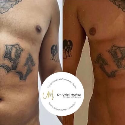 Before and After Result